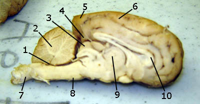 Sheep Brain 3