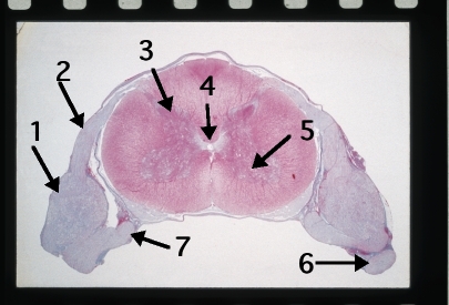 Spinal Cord 3
