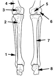 Lower Limb Leg Bones